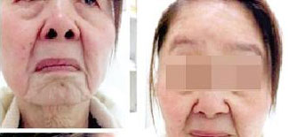 Young Henan Woman Ages Dramatically After Giving Birth