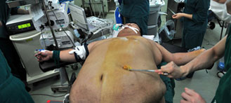“Guangxi’s First Fatty” Loses 80% of Weight After Operation