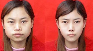 Shanghai Woman Refused HK Visa Due to Post Plastic Surgery Photo ID