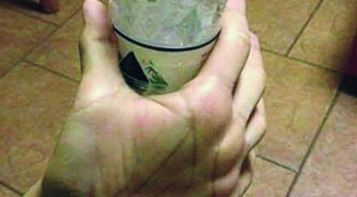 Man Takes Finger Bending Contest Too Far with Freaky Bottle Photo